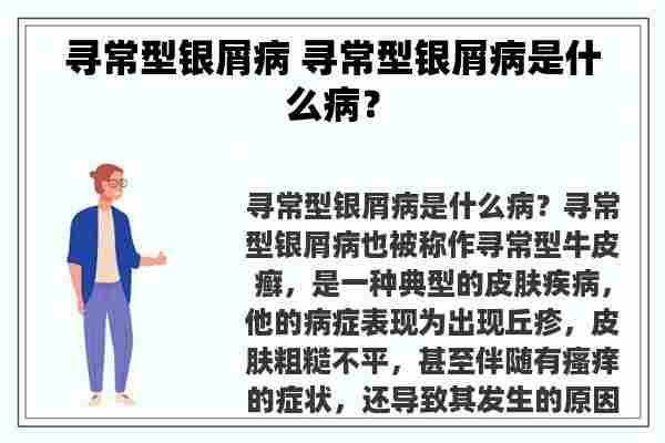 寻常型银屑病 寻常型银屑病是什么病？